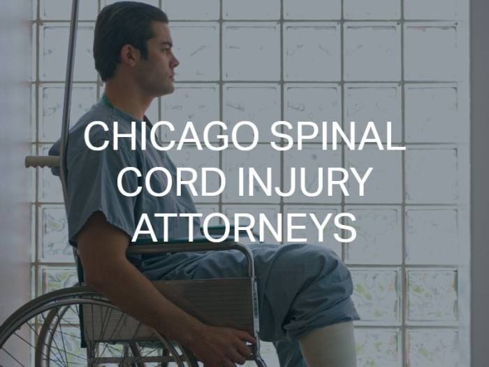Spinal Cord Injury | Chicago Personal Injury Lawyers Seidman, Margulis ...