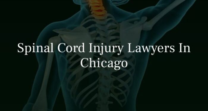 Chicago Spinal Cord Injury Lawyer
