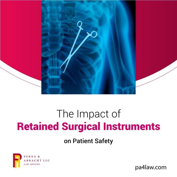 Surgeon Left an Instrument Inside Me: Can I Sue?